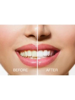 Rio Smile White Advanced Blue-Light Teeth Whitening Kit 8 Rio Smile White Advanced Blue-Light Teeth Whitening Kit -Appliance Pro M7YWA SQ3 0000000088 NO COLOR SLd