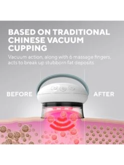 Homedics Smoothee IR -Appliance Pro RFCCE SQ4 0000000099 N A SLd1